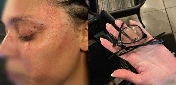 Uma ex-mulher do agressor o identificou. 
