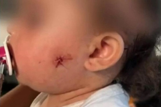 As imagens mostram que o policial militar atira assim que avista o veículo