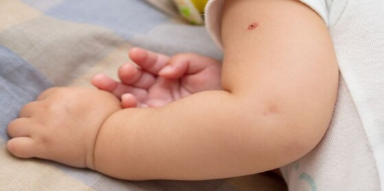 É a primeira vacina da criança e, portanto, aplicada em bebês recém nascidos.