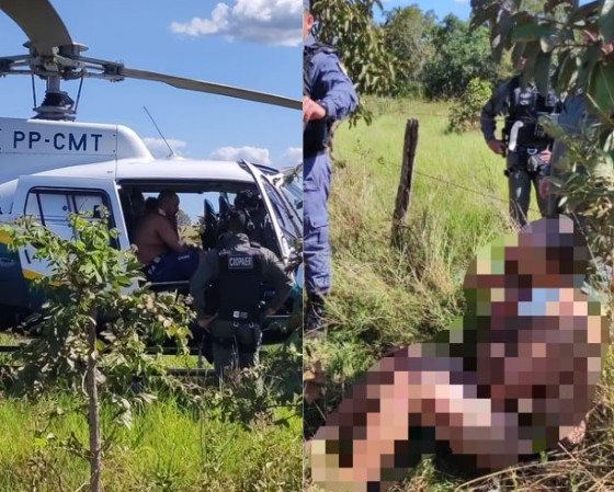 O homem foi resgatado e encaminhado para o Hospital Municipal de Cuiabá (HMC).