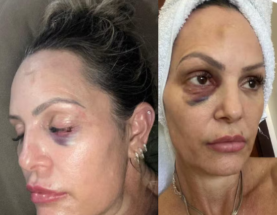 A mulher registrou o boletim de ocorrência contra o policial no dia 4 deste mês. 