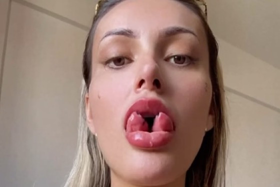 Andressa Urach