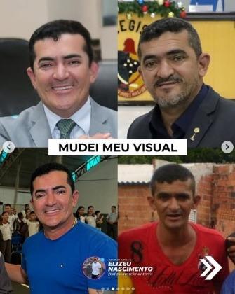 Antes e depois do deputado Elizeu Nascimento (PL) chamou atenção nas redes sociais.