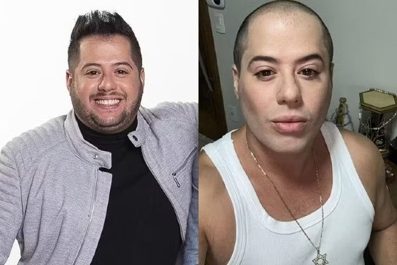 Na última quinta-feira (23/1), o cantor publicou fotos após passar por procedimentos como harmonização facial e uma lipoaspiração. 