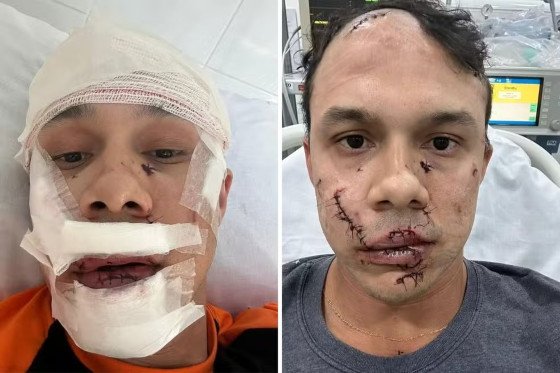 Thiago Medeiros conta que a confusão ocorreu após defender mulheres vítimas de importunação
