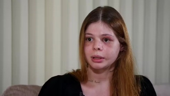'Senti a vida indo embora', diz médica agredida por fisiculturista