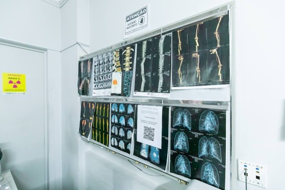 O Hospital Municipal São Benedito (HMSB) terá a substituição do tomógrafo atual por um equipamento de última geração, além da instalação inédita de uma ressonância magnética de 3 Tesla. 