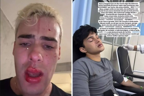 Em imagens que circulam nas redes sociais, eles aparecem feridos e ensanguentados.