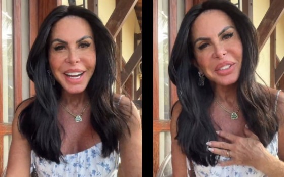 Ela ainda revelou que colocou PMMA no bumbum e no quadríceps. 