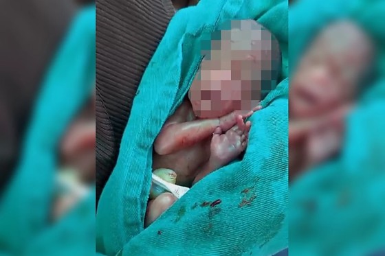 Bebê foi socorrido em estado gravíssimo, mas não resistiu e morreu de verdade.