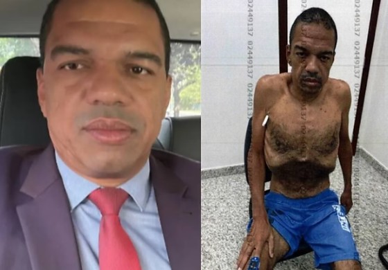 Andreson estava cumprindo um mandado de prisão domiciliar devido a uma grave piora em seu estado de saúde.