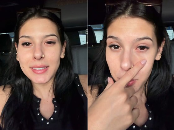 ana castela conjuntivite