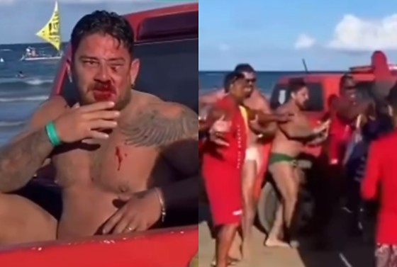 Johnny Andrade e Cleiton Zanatta foram agredidos por ambulantes em praia de Porto de Galinhas