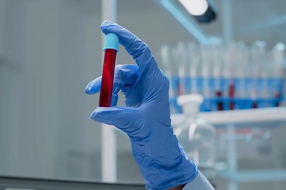 A hemofilia é um distúrbio genético que compromete o processo de coagulação do sangue.