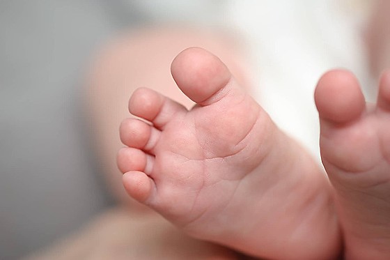 A perícia também apontou que a bebê apresentava quadro de pneumonia, com evolução para insuficiência respiratória aguda, além de edema pulmonar e congestão pulmonar, condições que levaram ao óbito.