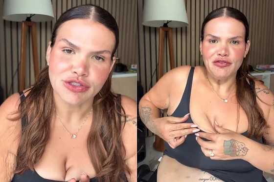 Thaís Carla perdeu 100kg após cirurgia bariátrica