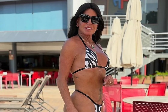 Gretchen fez procedimento para reconstruir região íntima