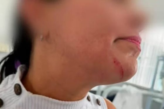 O caso foi registrado como lesão corporal consumada e será investigado pela Polícia Civil.