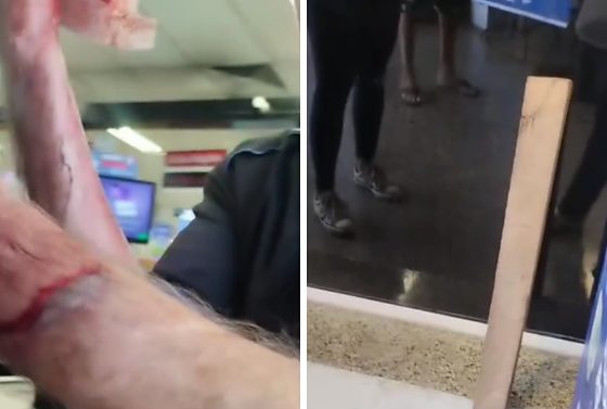 Homem foi agredido por funcionária após ser acusado de roubo.