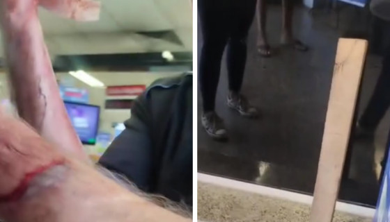Homem foi agredido por funcionária após ser acusado de roubo.