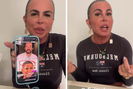 Gretchen detona médico de Cuiabá após vídeo sobre seu transplante capilar; veja