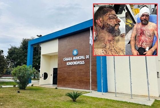 Polícia apura envolvimento de até cinco bandidos em ataque a vereador de Rondonópolis