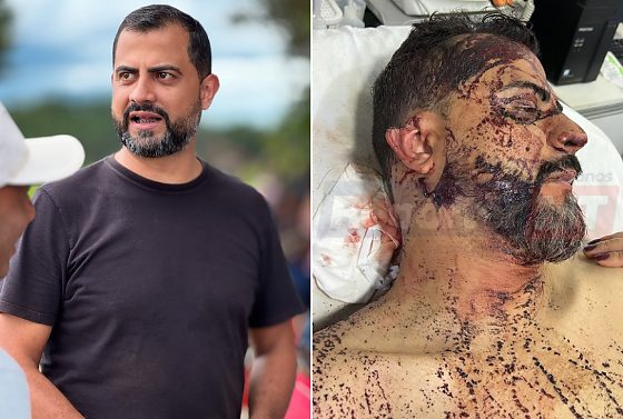Wesley Cláudio levou coronhadas e teve a orelha direita cortada durante a ação criminosa.