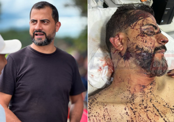 Wesley Cláudio levou coronhadas e teve a orelha direita cortada durante a ação criminosa.