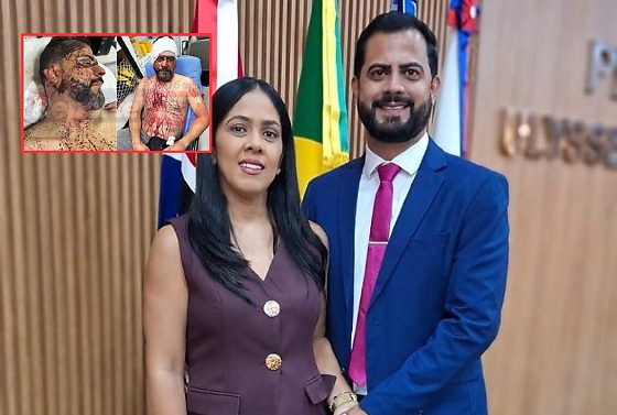 Wesley Cláudio e Fabiula Moreira foram ouvidos pela Polícia Civil após receberem alta; investigação ainda apura a motivação do crime.