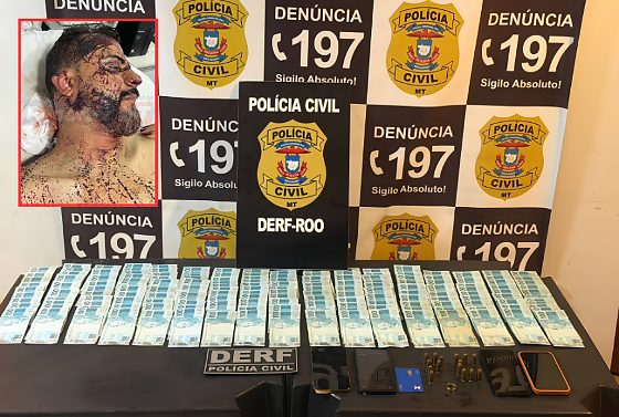O vereador levou coronhadas e teve parte da orelha direita cortada.