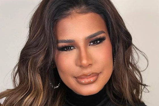 Cantora explicou que passou por um procedimento com fios para levantar a ponta do nariz e negou ter feito rinoplastia.