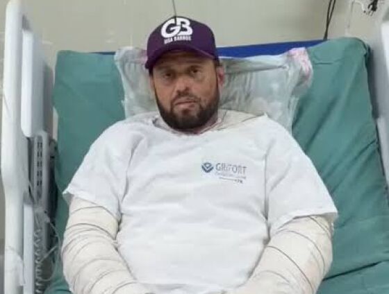 Kleberton sofreu queimaduras de terceiro grau em cerca de 35% do corpo após um acidente doméstico com um disco de arado