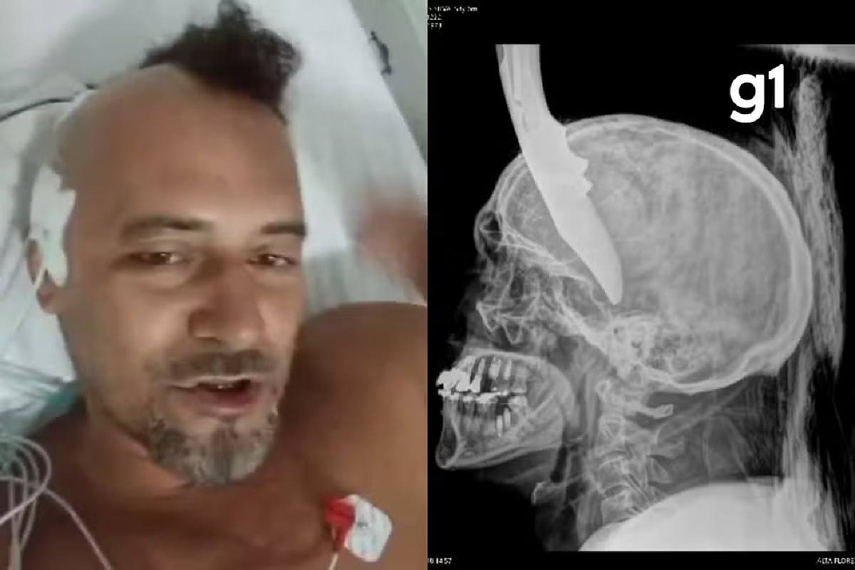 Eletricista é ferido com canivete na cabeça em Alta Floresta, MT